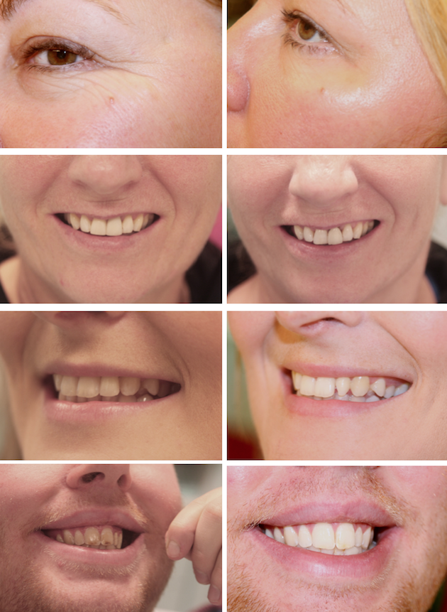 Measham Dental Practice images/advert_images/teeth-whitening_files/measham new.png